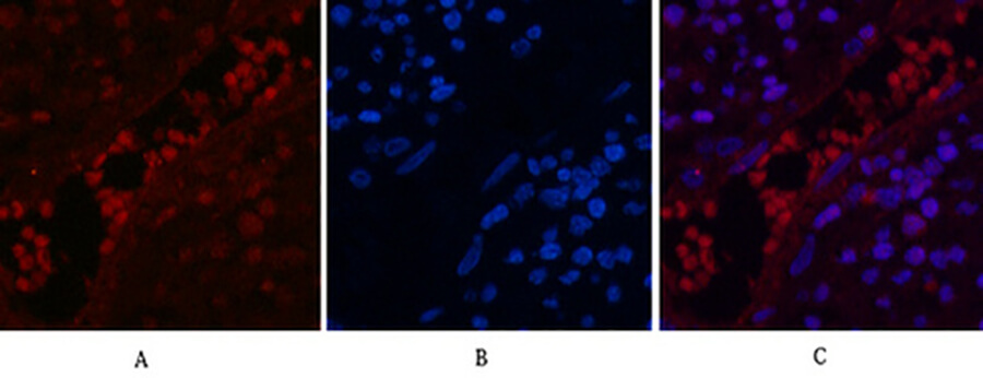 Fig.2. Immunofluorescence analysis of human appendix tissue. 1, NFκB-p65 (Acetyl Lys310) Polyclonal Antibody (red) was diluted at 1:200 (4°C, overnight). 2, Cy3 Labeled secondary antibody was diluted at 1:300 (room temperature, 50min). 3, Picture B: DAPI (blue) 10min. Picture A: Target. Picture B: DAPI. Picture C: merge of A+B.