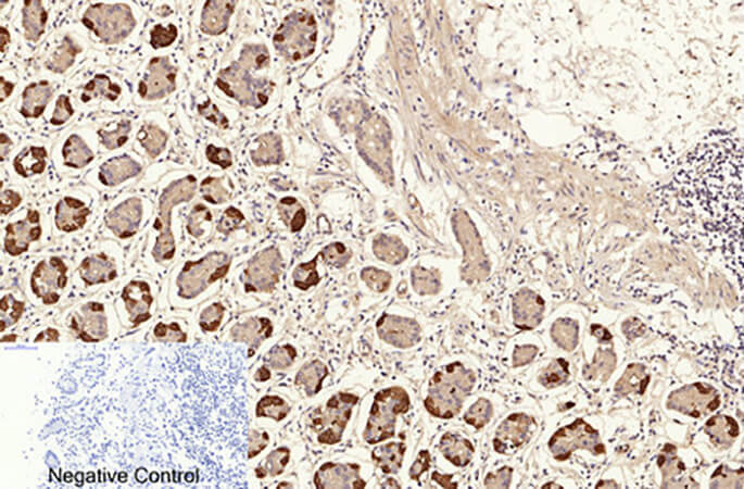 Fig.4. Immunohistochemical analysis of paraffin-embedded human stomach tissue. 1, NFκB-p65 (Acetyl Lys310) Polyclonal Antibody was diluted at 1:200 (4°C, overnight). 2, Sodium citrate pH 6.0 was used for antibody retrieval (>98°C, 20min). 3, secondary antibody was diluted at 1:200 (room temperature, 30min). Negative control was used by secondary antibody only.