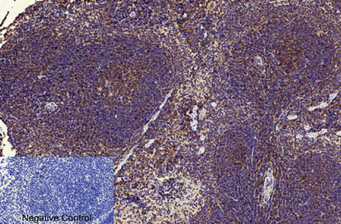 Fig.5. Immunohistochemical analysis of paraffin-embedded mouse spleen tissue. 1, NFκB-p65 (Acetyl Lys310) Polyclonal Antibody was diluted at 1:200 (4°C, overnight). 2, Sodium citrate pH 6.0 was used for antibody retrieval(>98°C, 20min). 3, secondary antibody was diluted at 1:200 (room temperature, 30min). Negative control was used by secondary antibody only.