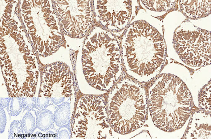 Fig.6. Immunohistochemical analysis of paraffin-embedded rat testis tissue. 1, NFκB-p65 (Acetyl Lys310) Polyclonal Antibody was diluted at 1:200 (4°C, overnight). 2, Sodium citrate pH 6.0 was used for antibody retrieval (>98°C, 20min). 3, secondary antibody was diluted at 1:200 (room temperature, 30min). Negative control was used by secondary antibody only.