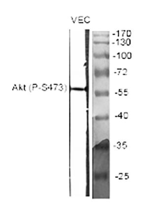 Fig.1. Western Blot analysis of various cells using Phospho-Akt (S473) Polyclonal Antibody diluted at 1:2000.