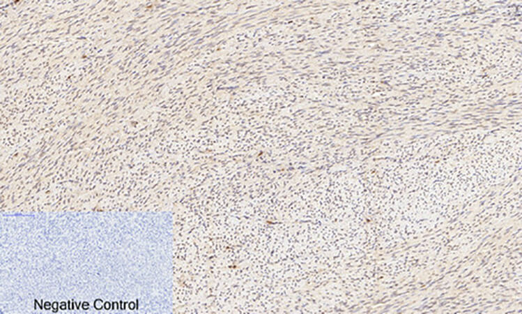 Fig.2. Immunohistochemical analysis of paraffin-embedded human uterus tissue. 1, Akt (phospho Ser473) Polyclonal Antibody was diluted at 1:200 (4°C, overnight). 2, Sodium citrate pH 6.0 was used for antibody retrieval (>98°C, 20min). 3, secondary antibody was diluted at 1:200 (room temperature, 30min). Negative control was used by secondary antibody only.