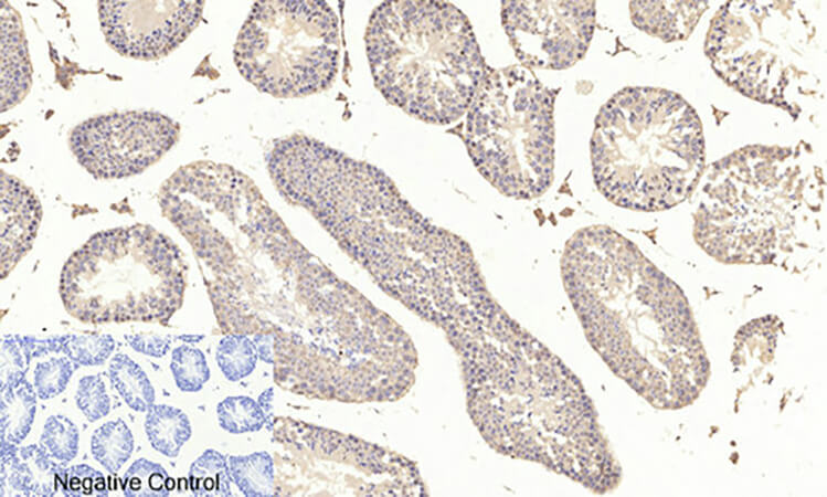 Fig.3. Immunohistochemical analysis of paraffin-embedded mouse testis tissue. 1, Akt (phospho Ser473) Polyclonal Antibody was diluted at 1:200 (4°C, overnight). 2, Sodium citrate pH 6.0 was used for antibody retrieval (>98°C, 20min). 3, secondary antibody was diluted at 1:200 (room temperature, 30min). Negative control was used by secondary antibody only.