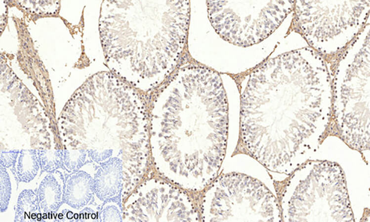 Fig.4. Immunohistochemical analysis of paraffin-embedded rat testis tissue. 1, Akt (phospho Ser473) Polyclonal Antibody was diluted at 1:200 (4°C, overnight). 2, Sodium citrate pH 6.0 was used for antibody retrieval (>98°C, 20min). 3, secondary antibody was diluted at 1:200 (room temperature, 30min). Negative control was used by secondary antibody only.