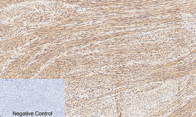 Fig.1. Immunohistochemical analysis of paraffin-embedded human uterus tissue. 1, CREB-1 (phospho Ser133) Polyclonal Antibody was diluted at 1:200 (4°C, overnight). 2, Sodium citrate pH 6.0 was used for antibody retrieval (>98°C, 20min). 3, secondary antibody was diluted at 1:200 (room temperature, 30min). Negative control was used by secondary antibody only.