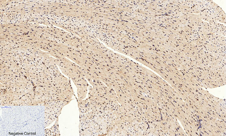 Fig.2. Immunohistochemical analysis of paraffin-embedded mouse heart tissue. 1, CREB-1 (phospho Ser133) Polyclonal Antibody was diluted at 1:200 (4°C, overnight). 2, Sodium citrate pH 6.0 was used for antibody retrieval (>98°C, 20min). 3, secondary antibody was diluted at 1:200 (room temperature, 30min). Negative control was used by secondary antibody only.