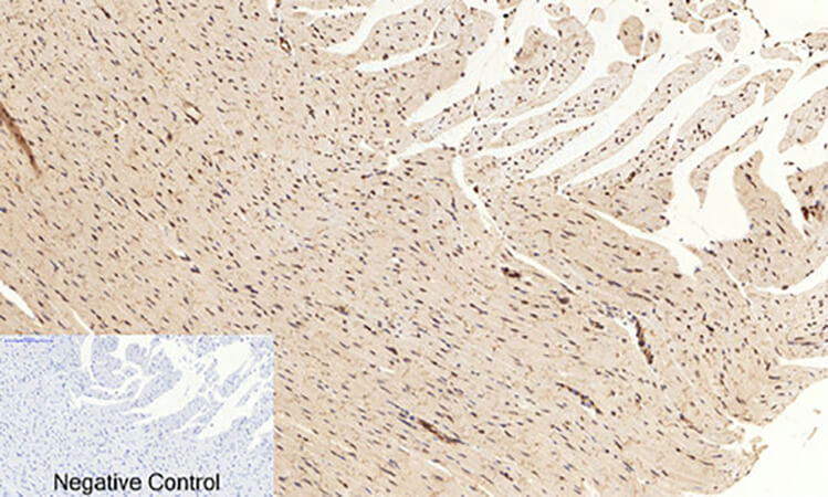 Fig.3. Immunohistochemical analysis of paraffin-embedded rat heart tissue. 1, CREB-1 (phospho Ser133) Polyclonal Antibody was diluted at 1:200 (4°C, overnight). 2, Sodium citrate pH 6.0 was used for antibody retrieval (>98°C, 20min). 3, secondary antibody was diluted at 1:200 (room temperature, 30min). Negative control was used by secondary antibody only.