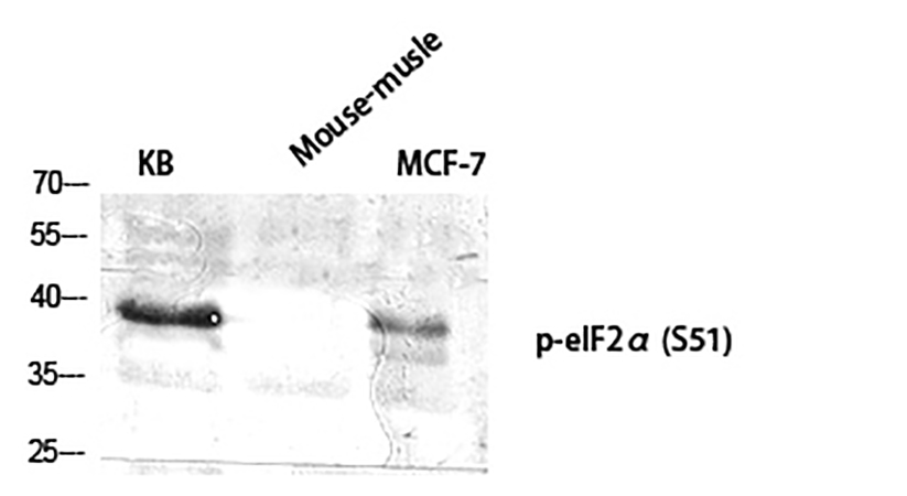 Fig.1. Western Blot analysis of KB (1), mouse-musle (2), MCF-7 (3), diluted at 1:2000.