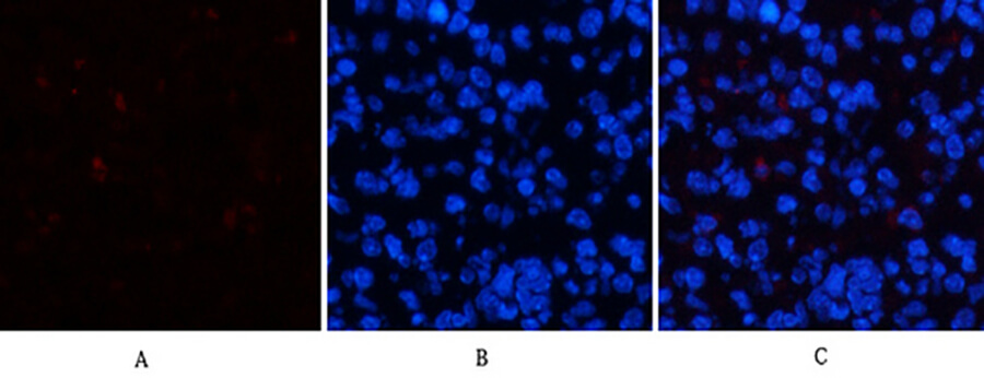 Fig.2. Immunofluorescence analysis of mouse spleen tissue. 1, ERK 1/2 (phospho Tyr204) Polyclonal Antibody (red) was diluted at 1:200 (4°C, overnight). 2, Cy3 Labeled secondary antibody was diluted at 1:300 (room temperature, 50min). 3, Picture B: DAPI (blue) 10min. Picture A: Target. Picture B: DAPI. Picture C: merge of A+B.