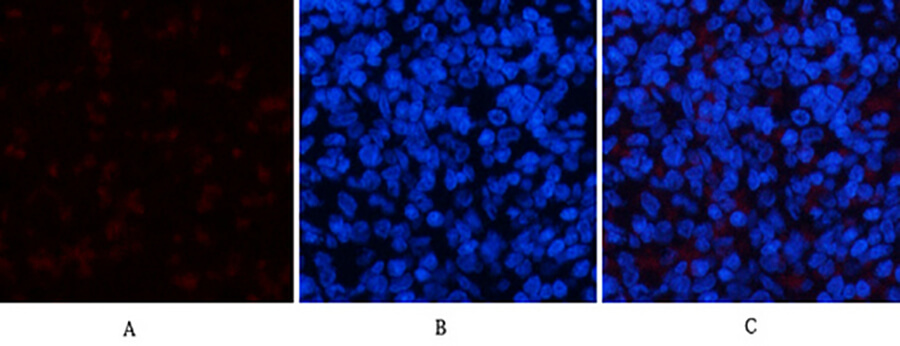 Fig.3. Immunofluorescence analysis of rat spleen tissue. 1, ERK 1/2 (phospho Tyr204) Polyclonal Antibody (red) was diluted at 1:200 (4°C, overnight). 2, Cy3 Labeled secondary antibody was diluted at 1:300 (room temperature, 50min). 3, Picture B: DAPI (blue) 10min. Picture A: Target. Picture B: DAPI. Picture C: merge of A+B.