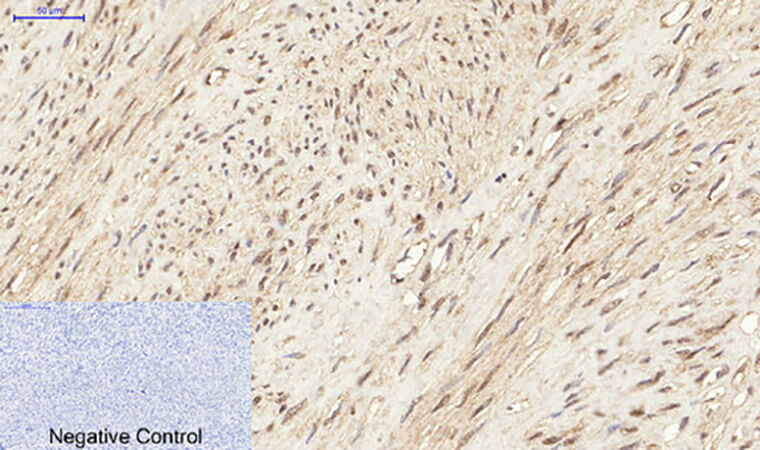 Fig.4. Immunohistochemical analysis of paraffin-embedded human uterus tissue. 1, ERK 1/2 (phospho Tyr204) Polyclonal Antibody was diluted at 1:200 (4°C, overnight). 2, Sodium citrate pH 6.0 was used for antibody retrieval (>98°C, 20min). 3, secondary antibody was diluted at 1:200 (room temperature, 30min). Negative control was used by secondary antibody only.