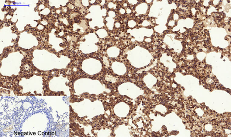 Fig.5. Immunohistochemical analysis of paraffin-embedded mouse lung tissue. 1, ERK 1/2 (phospho Tyr204) Polyclonal Antibody was diluted at 1:200 (4°C, overnight). 2, Sodium citrate pH 6.0 was used for antibody retrieval (>98°C, 20min). 3, secondary antibody was diluted at 1:200 (room temperature, 30min). Negative control was used by secondary antibody only.