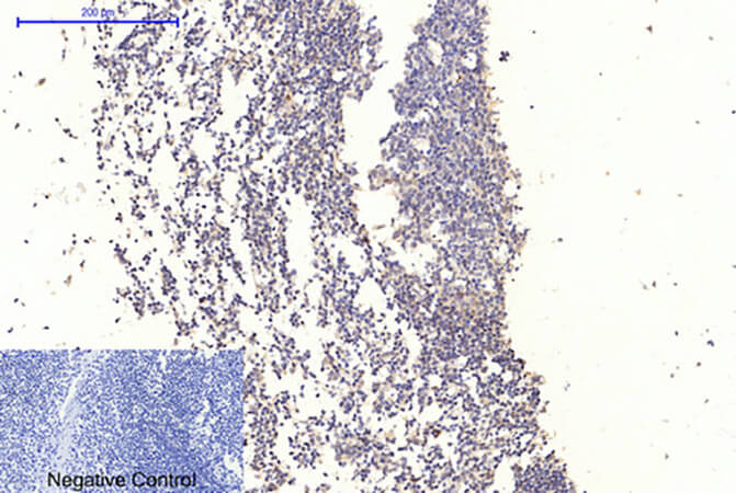 Fig.1. Immunohistochemical analysis of paraffin-embedded human tonsil tissue. 1, GSK3α/β (phospho Tyr279/216) Polyclonal Antibody was diluted at 1:200 (4°C, overnight). 2, Sodium citrate pH 6.0 was used for antibody retrieval (>98°C, 20min). 3, secondary antibody was diluted at 1:200 (room temperature, 30min). Negative control was used by secondary antibody only.