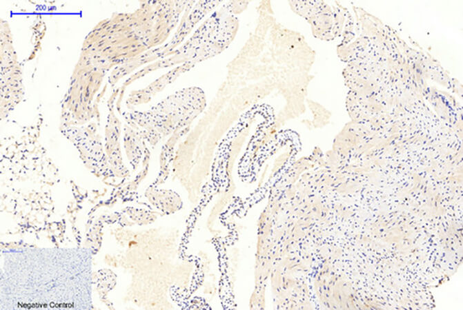 Fig.2. Immunohistochemical analysis of paraffin-embedded mouse heart tissue. 1, GSK3α/β (phospho Tyr279/216) Polyclonal Antibody was diluted at 1:200 (4°C, overnight). 2, Sodium citrate pH 6.0 was used for antibody retrieval (>98°C, 20min). 3, secondary antibody was diluted at 1:200 (room temperature, 30min). Negative control was used by secondary antibody only.