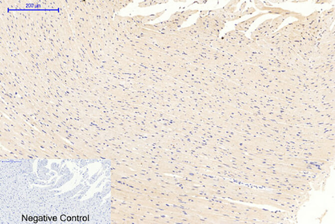 Fig.3. Immunohistochemical analysis of paraffin-embedded rat heart tissue. 1, GSK3α/β (phospho Tyr279/216) Polyclonal Antibody was diluted at 1:200 (4°C, overnight). 2, Sodium citrate pH 6.0 was used for antibody retrieval (>98°C, 20min). 3, secondary antibody was diluted at 1:200 (room temperature, 30min). Negative control was used by secondary antibody only.