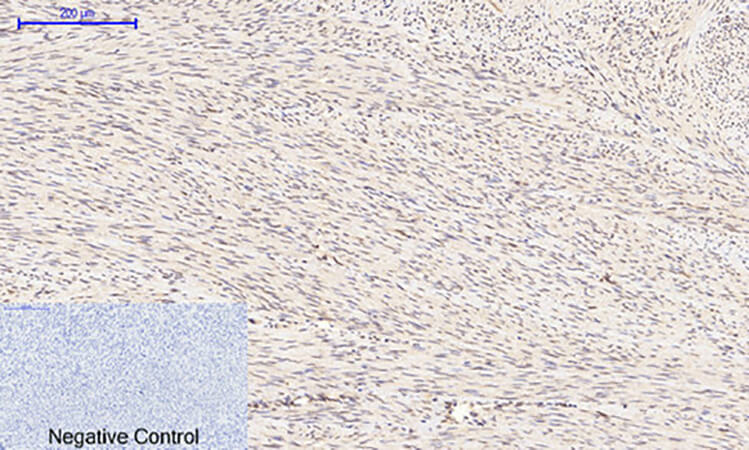Fig.2. Immunohistochemical analysis of paraffin-embedded human uterus tissue. 1, GSK3β (phospho Ser9) Polyclonal Antibody was diluted at 1:200 (4°C, overnight). 2, Sodium citrate pH 6.0 was used for antibody retrieval (>98°C, 20min). 3, secondary antibody was diluted at 1:200 (room temperature, 30min). Negative control was used by secondary antibody only.