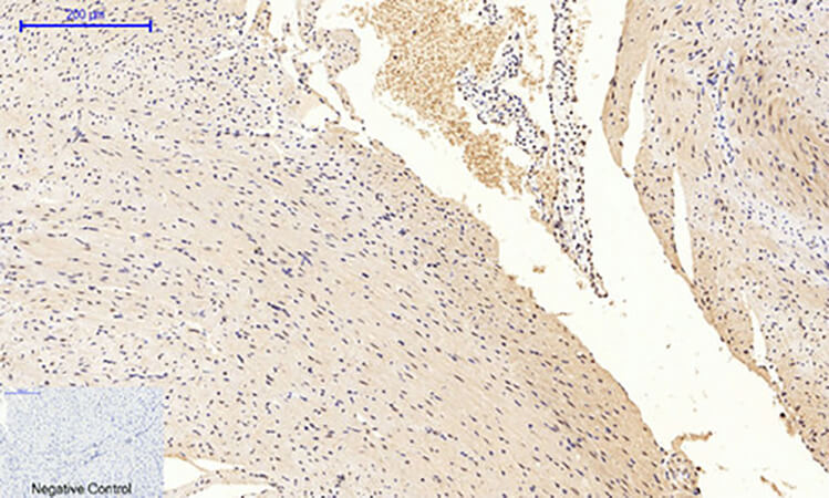 Fig.3. Immunohistochemical analysis of paraffin-embedded mouse heart tissue. 1, GSK3β (phospho Ser9) Polyclonal Antibody was diluted at 1:200 (4°C, overnight). 2, Sodium citrate pH 6.0 was used for antibody retrieval (>98°C, 20min). 3, secondary antibody was diluted at 1:200 (room temperature, 30min). Negative control was used by secondary antibody only.