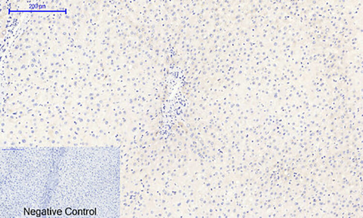 Fig.2. Immunohistochemical analysis of paraffin-embedded human liver tissue. 1, IκB-α (phospho Ser32/S36) Polyclonal Antibody was diluted at 1:200 (4°C, overnight). 2, Sodium citrate pH 6.0 was used for antibody retrieval (>98°C, 20min). 3, secondary antibody was diluted at 1:200 (room temperature, 30min). Negative control was used by secondary antibody only.