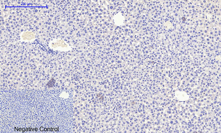 Fig.3. Immunohistochemical analysis of paraffin-embedded mouse liver tissue. 1, IκB-α (phospho Ser32/S36) Polyclonal Antibody was diluted at 1:200 (4°C, overnight). 2, Sodium citrate pH 6.0 was used for antibody retrieval (>98°C, 20min). 3, secondary antibody was diluted at 1:200 (room temperature, 30min). Negative control was used by secondary antibody only.