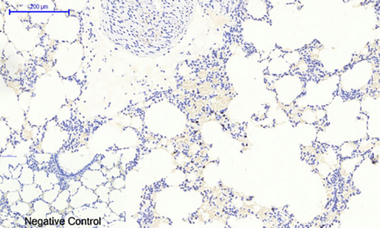 Fig.4. Immunohistochemical analysis of paraffin-embedded rat lung tissue. 1, IκB-α (phospho Ser32/S36) Polyclonal Antibody was diluted at 1:200 (4°C, overnight). 2, Sodium citrate pH 6.0 was used for antibody retrieval (>98°C, 20min). 3, secondary antibody was diluted at 1:200 (room temperature, 30min). Negative control was used by secondary antibody only.