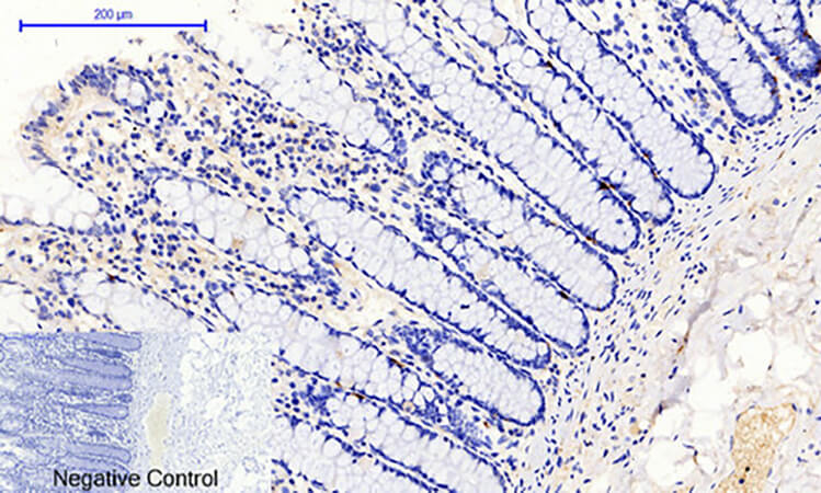 Fig.2. Immunohistochemical analysis of paraffin-embedded human colon tissue. 1, JAK1 (phospho Tyr1022) Polyclonal Antibody was diluted at 1:200 (4°C, overnight). 2, Sodium citrate pH 6.0 was used for antibody retrieval (>98°C, 20min). 3, secondary antibody was diluted at 1:200 (room temperature, 30min). Negative control was used by secondary antibody only.