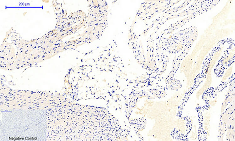 Fig.3. Immunohistochemical analysis of paraffin-embedded mouse heart tissue. 1, JAK1 (phospho Tyr1022) Polyclonal Antibody was diluted at 1:200 (4°C, overnight). 2, Sodium citrate pH 6.0 was used for antibody retrieval (>98°C, 20min). 3, secondary antibody was diluted at 1:200 (room temperature, 30min). Negative control was used by secondary antibody only.