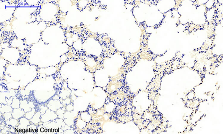 Fig.4. Immunohistochemical analysis of paraffin-embedded rat lung tissue. 1, JAK1 (phospho Tyr1022) Polyclonal Antibody was diluted at 1:200 (4°C, overnight). 2, Sodium citrate pH 6.0 was used for antibody retrieval (>98°C, 20min). 3, secondary antibody was diluted at 1:200 (room temperature, 30min). Negative control was used by secondary antibody only.