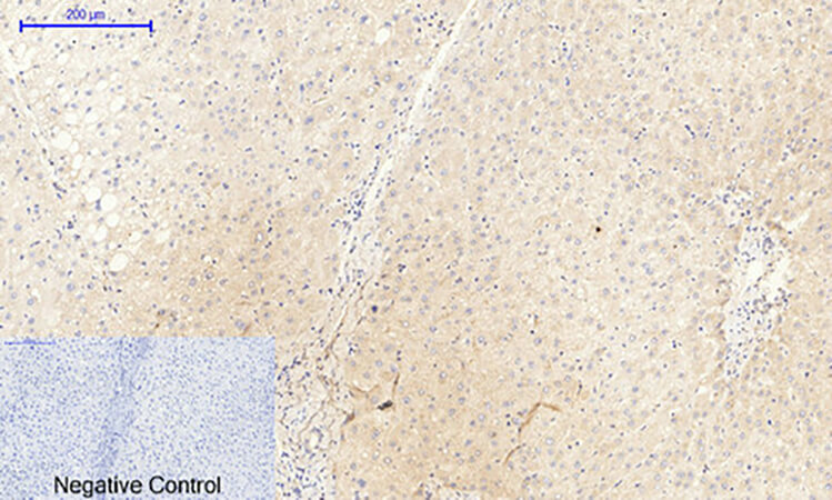 Fig.2. Immunohistochemical analysis of paraffin-embedded human liver tissue. 1, JAK2 (phospho Tyr1007) Polyclonal Antibody was diluted at 1:200 (4°C, overnight). 2, Sodium citrate pH 6.0 was used for antibody retrieval (>98°C, 20min). 3, secondary antibody was diluted at 1:200 (room temperature, 30min). Negative control was used by secondary antibody only.
