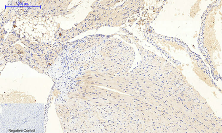 Fig.3. Immunohistochemical analysis of paraffin-embedded mouse heart tissue. 1, JAK2 (phospho Tyr1007) Polyclonal Antibody was diluted at 1:200 (4°C, overnight). 2, Sodium citrate pH 6.0 was used for antibody retrieval (>98°C, 20min). 3, secondary antibody was diluted at 1:200 (room temperature, 30min). Negative control was used by secondary antibody only.