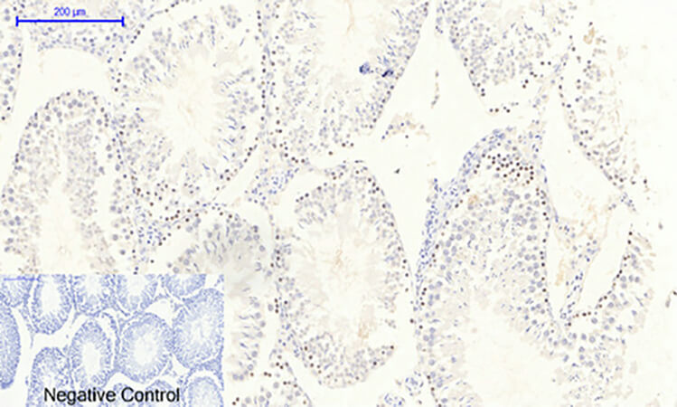 Fig.4. Immunohistochemical analysis of paraffin-embedded rat testis tissue. 1, JAK2 (phospho Tyr1007) Polyclonal Antibody was diluted at 1:200 (4°C, overnight). 2, Sodium citrate pH 6.0 was used for antibody retrieval (>98°C, 20min). 3, secondary antibody was diluted at 1:200 (room temperature, 30min). Negative control was used by secondary antibody only.