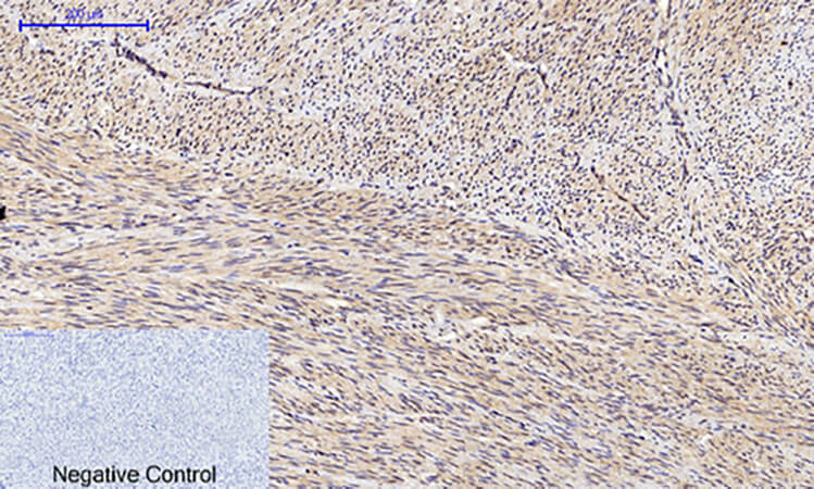 Fig.2. Immunohistochemical analysis of paraffin-embedded human uterus tissue. 1, JNK1/2/3 (phospho Thr183) Polyclonal Antibody was diluted at 1:200 (4°C, overnight). 2, Sodium citrate pH 6.0 was used for antibody retrieval (>98°C, 20min). 3, secondary antibody was diluted at 1:200 (room temperature, 30min). Negative control was used by secondary antibody only.
