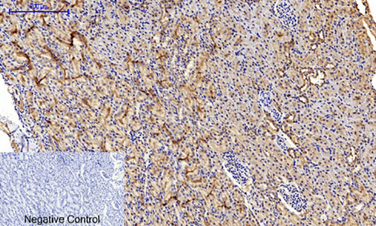 Fig.4. Immunohistochemical analysis of paraffin-embedded rat kidney tissue. 1, JNK1/2/3 (phospho Thr183) Polyclonal Antibody was diluted at 1:200 (4°C, overnight). 2, Sodium citrate pH 6.0 was used for antibody retrieval (>98°C, 20min). 3, secondary antibody was diluted at 1:200 (room temperature, 30min). Negative control was used by secondary antibody only.