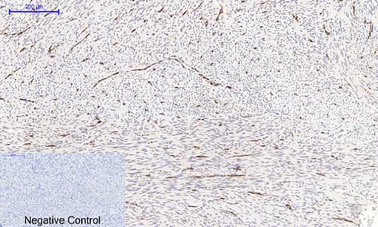 Fig.2. Immunohistochemical analysis of paraffin-embedded human uterus tissue. 1, NFκB-p65 (phospho Ser536) Polyclonal Antibody was diluted at 1:200 (4°C, overnight). 2, Sodium citrate pH 6.0 was used for antibody retrieval (>98°C, 20min). 3, secondary antibody was diluted at 1:200 (room temperature, 30min). Negative control was used by secondary antibody only.