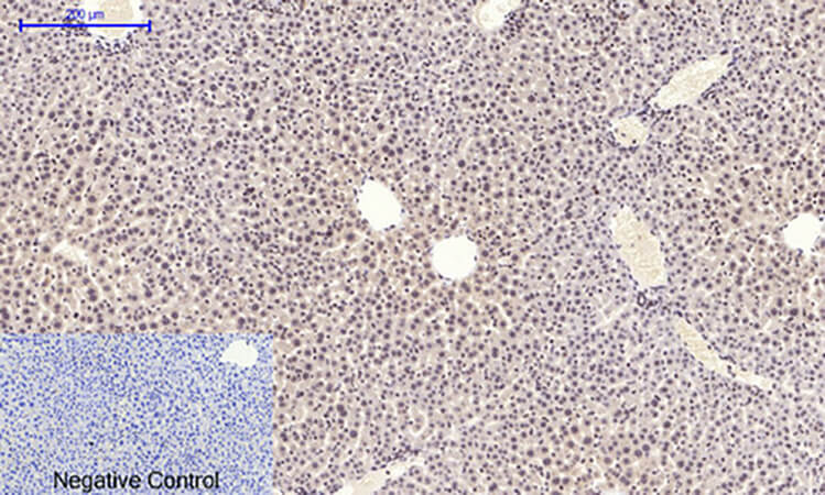 Fig.3. Immunohistochemical analysis of paraffin-embedded mouse liver tissue. 1, NFκB-p65 (phospho Ser536) Polyclonal Antibody was diluted at 1:200 (4°C, overnight). 2, Sodium citrate pH 6.0 was used for antibody retrieval (>98°C, 20min). 3, secondary antibody was diluted at 1:200 (room temperature, 30min). Negative control was used by secondary antibody only.