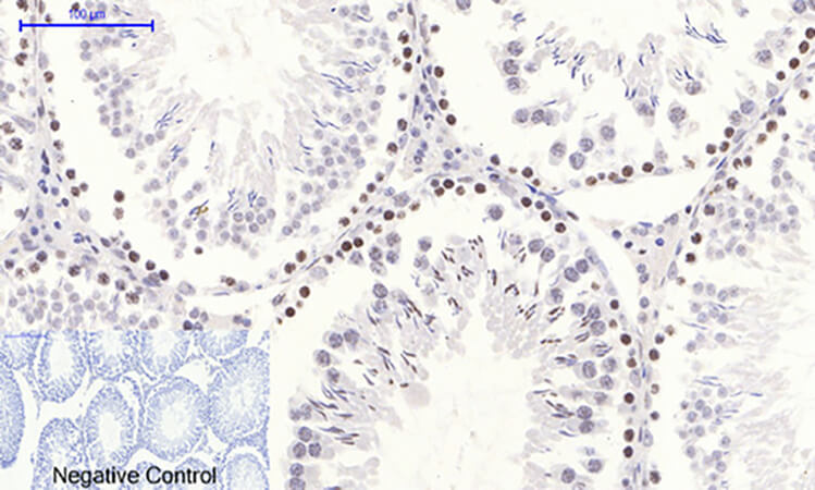 Fig.4. Immunohistochemical analysis of paraffin-embedded rat testis tissue. 1, NFκB-p65 (phospho Ser536) Polyclonal Antibody was diluted at 1:200 (4°C, overnight). 2, Sodium citrate pH 6.0 was used for antibody retrieval (>98°C, 20min). 3, secondary antibody was diluted at 1:200 (room temperature, 30min). Negative control was used by secondary antibody only.