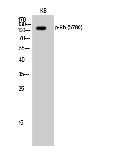 Fig.2. Western Blot analysis of KB cells using Phospho-Rb (S780) Polyclonal Antibody.