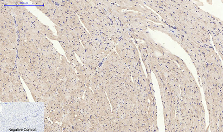 Fig.4. Immunohistochemical analysis of paraffin-embedded mouse heart tissue. 1, Stat3 (phospho Ser727) Polyclonal Antibody was diluted at 1:200 (4°C, overnight). 2, Sodium citrate pH 6.0 was used for antibody retrieval (>98°C, 20min). 3, secondary antibody was diluted at 1:200 (room temperature, 30min). Negative control was used by secondary antibody only.