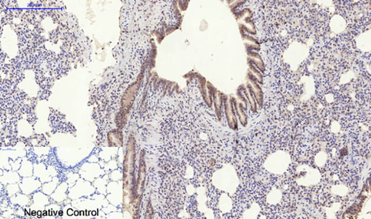 Fig.5. Immunohistochemical analysis of paraffin-embedded rat lung tissue. 1, Stat3 (phospho Ser727) Polyclonal Antibody was diluted at 1:200 (4°C, overnight). 2, Sodium citrate pH 6.0 was used for antibody retrieval (>98°C, 20min). 3, secondary antibody was diluted at 1:200 (room temperature, 30min). Negative control was used by secondary antibody only.