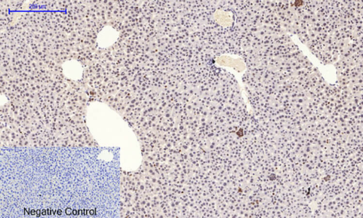 Fig.3. Immunohistochemical analysis of paraffin-embedded mouse liver tissue. 1, p38 (phospho Thr180/Y182) Polyclonal Antibody was diluted at 1:200 (4°C, overnight). 2, Sodium citrate pH 6.0 was used for antibody retrieval (>98°C, 20min). 3, secondary antibody was diluted at 1:200 (room temperature, 30min). Negative control was used by secondary antibody only.