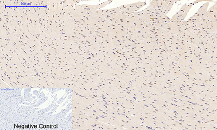 Fig.4. Immunohistochemical analysis of paraffin-embedded rat heart tissue. 1, p38 (phospho Thr180/Y182) Polyclonal Antibody was diluted at 1:200 (4°C, overnight). 2, Sodium citrate pH 6.0 was used for antibody retrieval (>98°C, 20min). 3, secondary antibody was diluted at 1:200 (room temperature, 30min). Negative control was used by secondary antibody only.