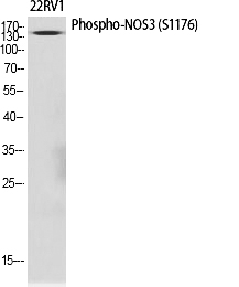 Fig.1. Western Blot analysis of various cells using Phospho-NOS3 (S1177) Polyclonal Antibody diluted at 1:1000.