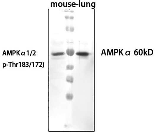 Fig. Western Blot analysis of mouse lung cells using primary antibody diluted at 1:1000 (4°C overnight).