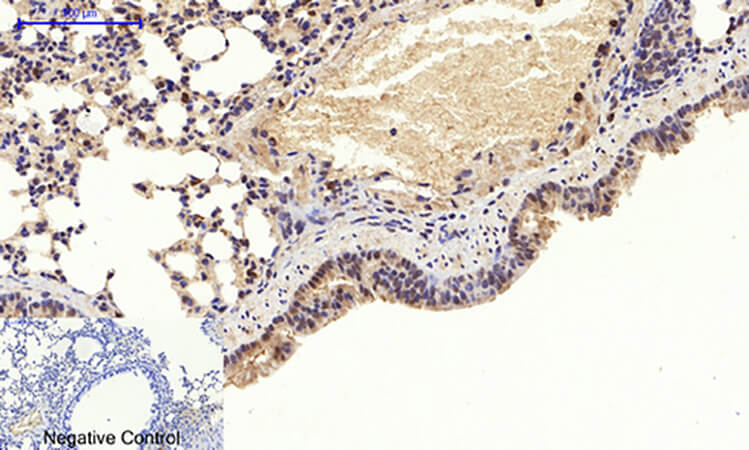 Fig.3. Immunohistochemical analysis of paraffin-embedded mouse lung tissue. 1, Akt (phospho Thr308) Polyclonal Antibody was diluted at 1:200 (4°C, overnight). 2, Sodium citrate pH 6.0 was used for antibody retrieval (>98°C, 20min). 3, secondary antibody was diluted at 1:200 (room temperature, 30min). Negative control was used by secondary antibody only.
