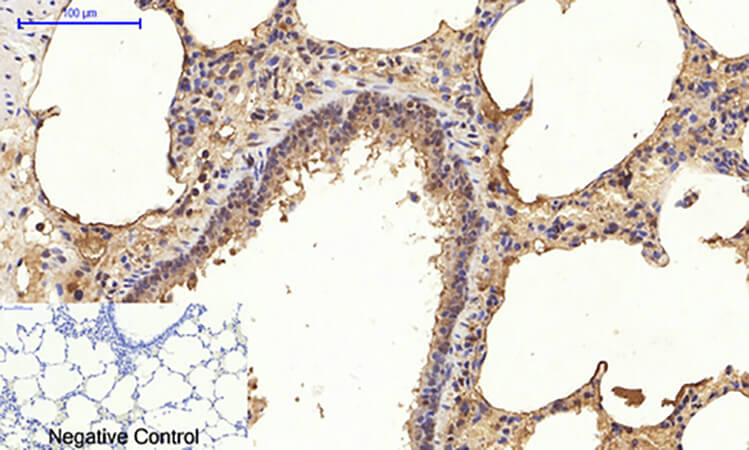 Fig.4. Immunohistochemical analysis of paraffin-embedded rat lung tissue. 1, Akt (phospho Thr308) Polyclonal Antibody was diluted at 1:200 (4°C, overnight). 2, Sodium citrate pH 6.0 was used for antibody retrieval (>98°C, 20min). 3, secondary antibody was diluted at 1:200 (room temperature, 30min). Negative control was used by secondary antibody only.