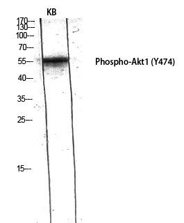 Fig.3. Western Blot analysis of KB using Phospho-Akt1 (Y474) Polyclonal Antibody diluted at 1:1000.