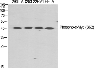 Fig.1. Western Blot analysis of various cells using Phospho-c-Myc (S62) Polyclonal Antibody diluted at 1:1000.