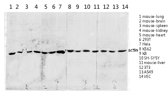 Fig.4. Western blot analysis of various lysis using Actin Polyclonal Antibody diluted at 1:2000. Secondary antibody was diluted at 1:20000.