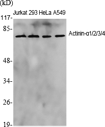 Fig.1. Western Blot analysis of various cells using Actinin-α1/2/3/4 Polyclonal Antibody diluted at 1:1000.
