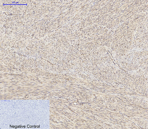 Fig.2. Immunohistochemical analysis of paraffin-embedded human uterus tissue. 1, Akt1 Polyclonal Antibody was diluted at 1:200 (4°C, overnight). 2, Sodium citrate pH 6.0 was used for antibody retrieval (>98°C, 20min). 3, secondary antibody was diluted at 1:200 (room temperature, 30min). Negative control was used by secondary antibody only.