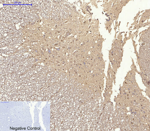 Fig.2. Immunohistochemical analysis of paraffin-embedded rat spinal cord tissue. 1, Akt Polyclonal Antibody was diluted at 1:200 (4°C, overnight). 2, Sodium citrate pH 6.0 was used for antibody retrieval (>98°C, 20min). 3, secondary antibody was diluted at 1:200 (room temperature, 30min). Negative control was used by secondary antibody only.